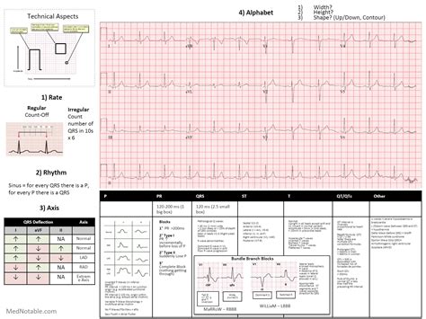 normal ecg 12 lead|12 lead ekg interpretation cheat sheet.